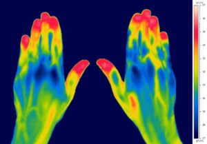Thermal Image